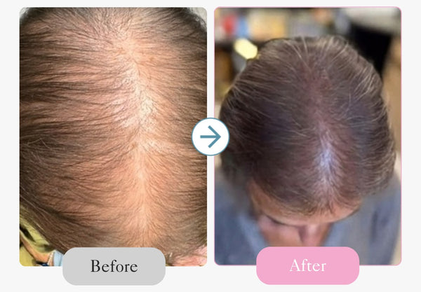 Great for early-stage thinning