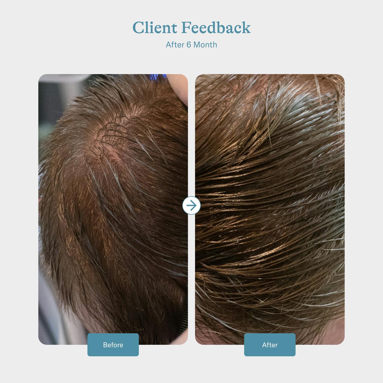 Keratin Hair Booster - Men before/after