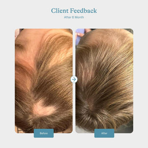 Keratin Hair Booster - Women 18–45