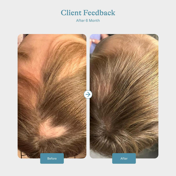 Keratin Hair Booster - Women 18–45