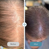 Intensive Hair Care System - The Reset