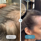 Intensive Hair Care System - The Reset
