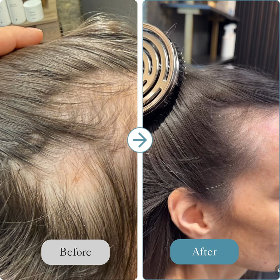 Intensive Hair Care System - The Reset