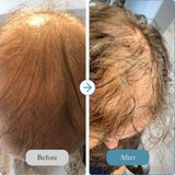 Intensive Hair Care System - The Reset