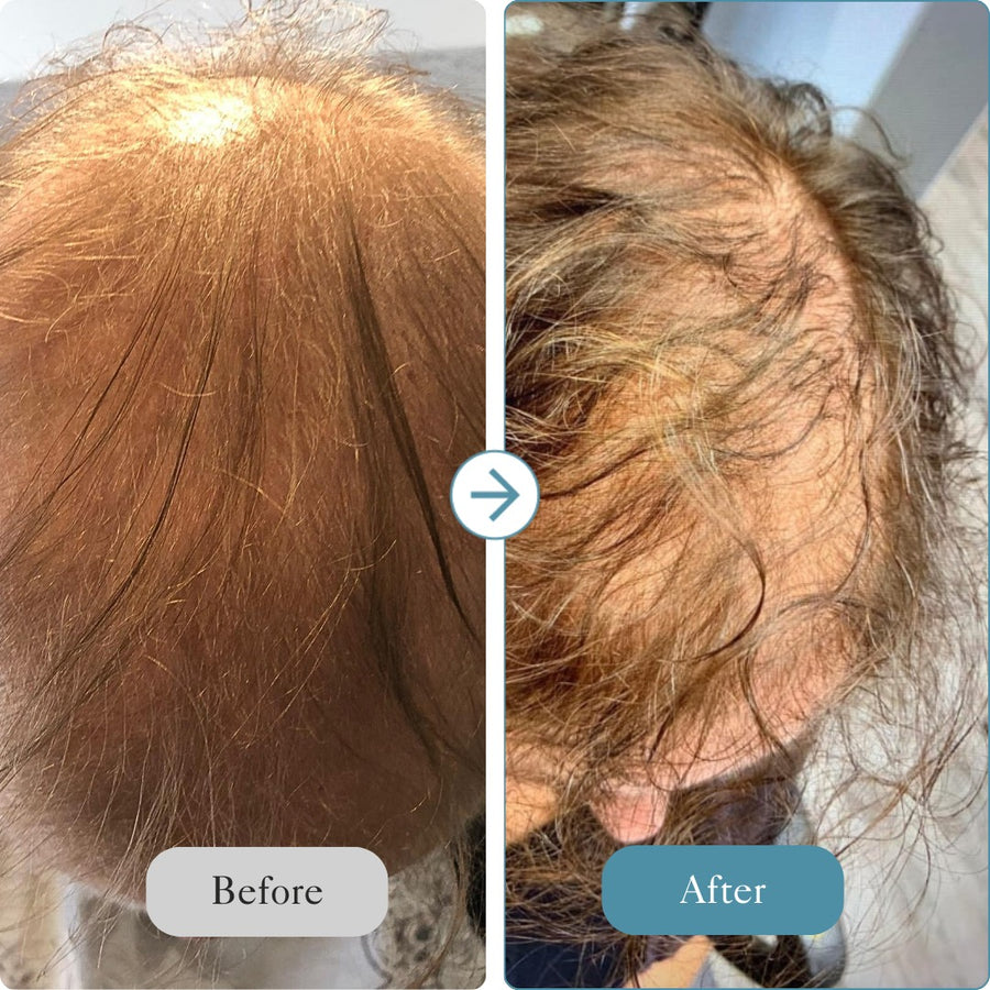 Intensive Hair Care System - The Reset