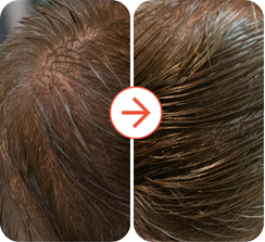 Great for early-stage thinning