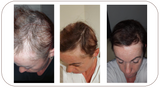 Intensive Hair Care System - The Reset