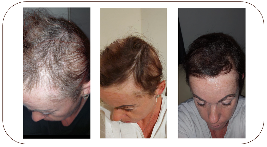 Intensive Hair Care System - The Reset