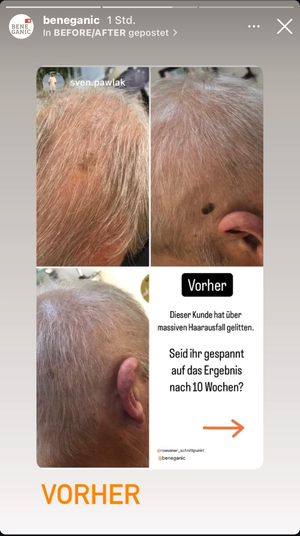 Keratin Hair Booster - Men