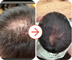 Noticeable reduction in shedding!