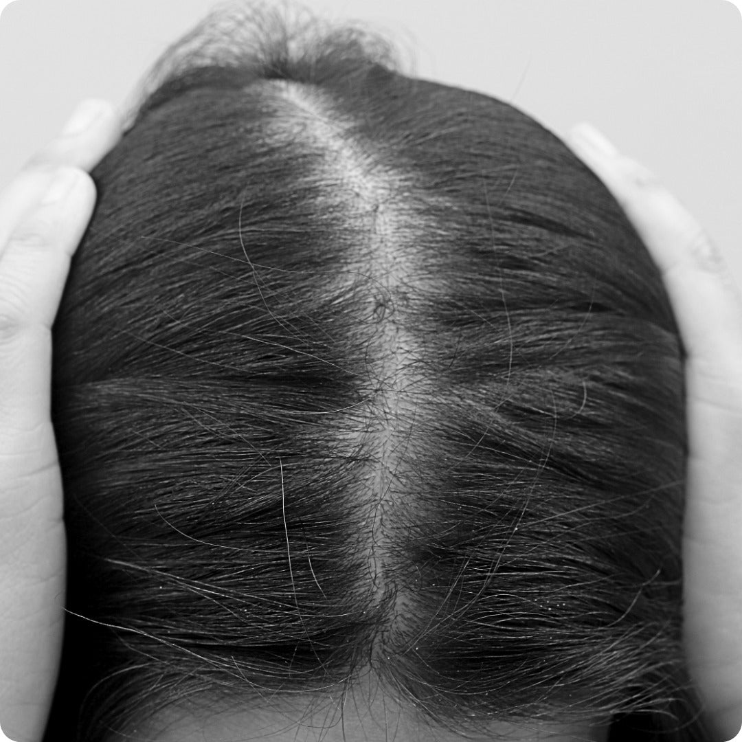 HAIR LOSS CAN FEEL LIKE LOSING YOURSELF